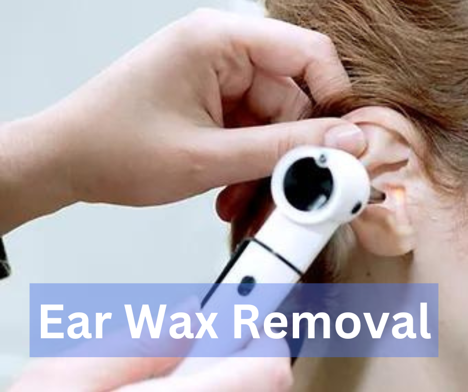 Ear Wax Removal at Surrey Injury Clinic Horley 